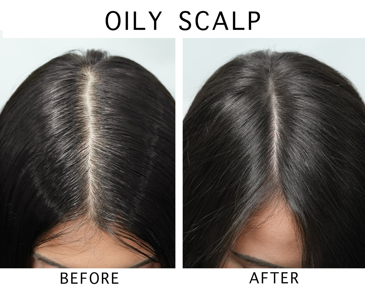 ScalpFacial™ for Oily Scalp & Scalp Massage Brush Kit